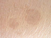 サラッとしたコンシーラー