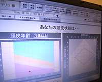 頭皮年齢