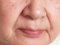 画像の代替テキスト