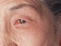 画像の代替テキスト