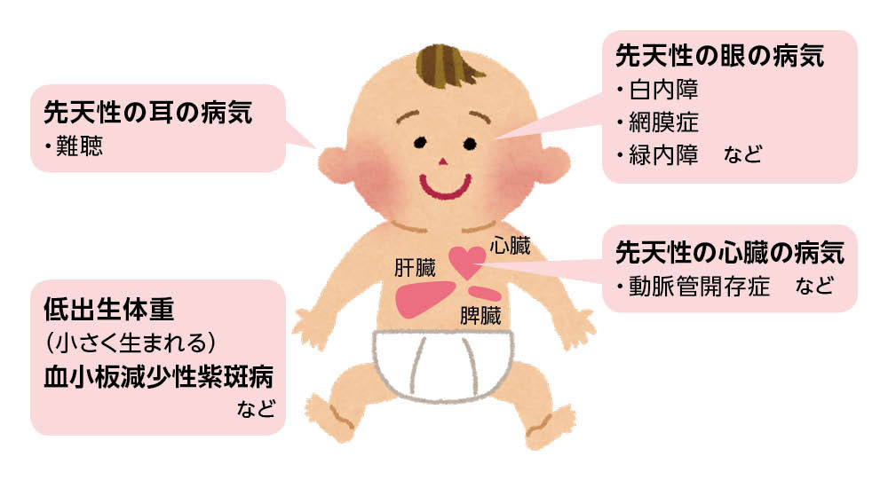 風しんも飛沫で感染する!今「昭和37~53年度生まれの男性」が無料の抗体検査を受けるべき理由とは